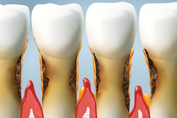 teeth and gums th adolescent patient